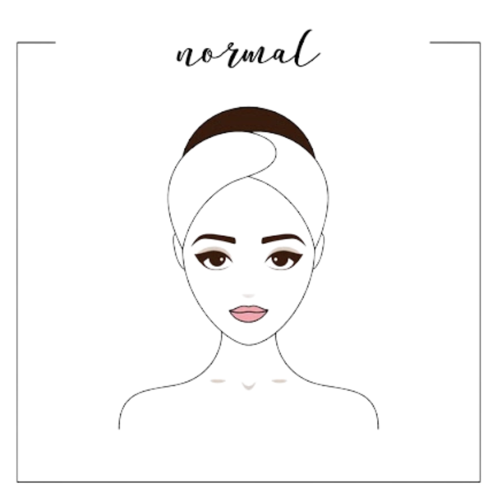 Normal