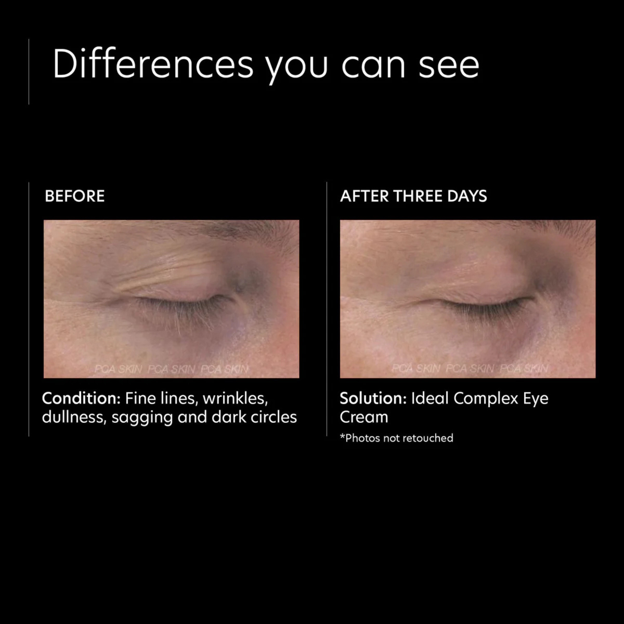 Ideal Complex® Restorative Eye Cream