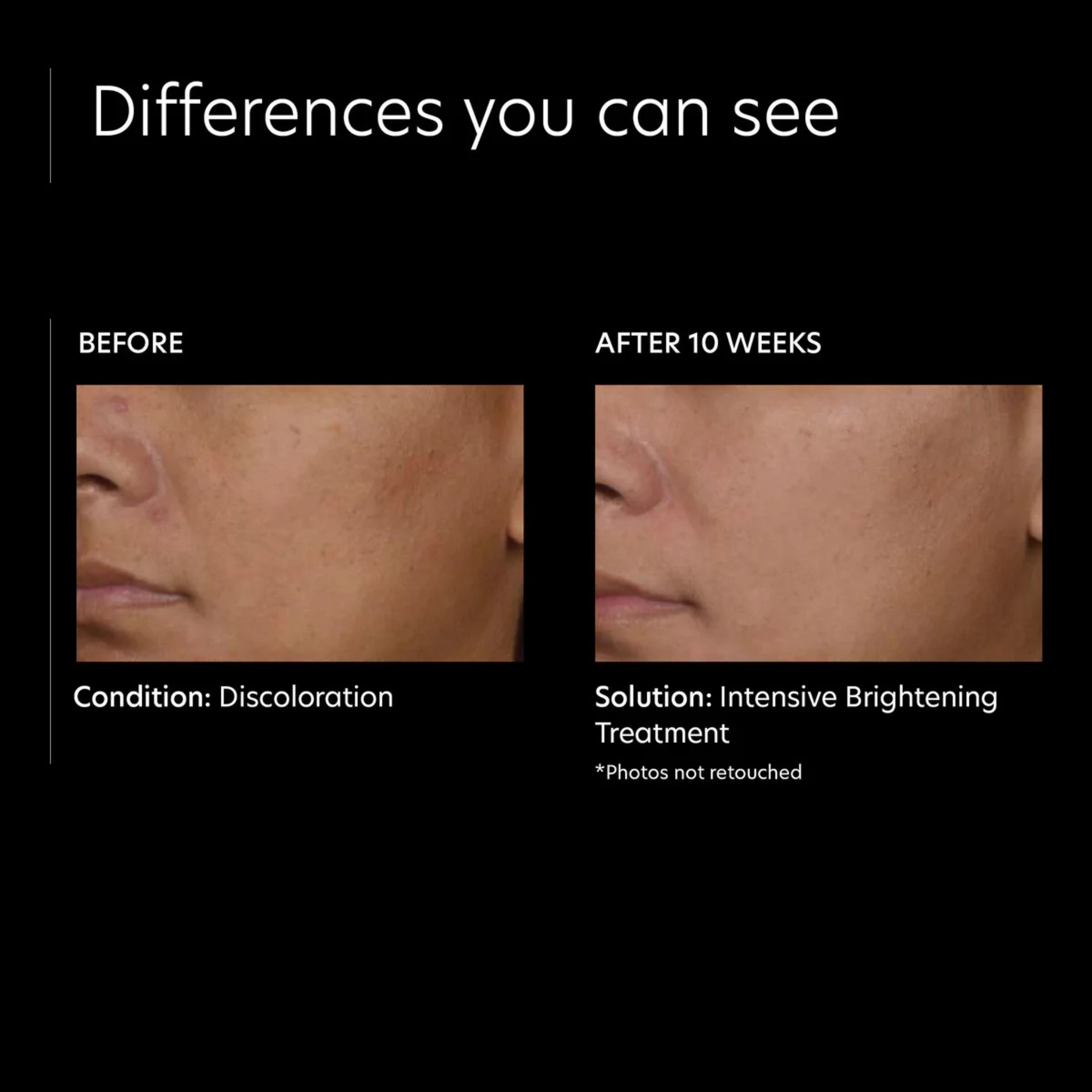 Intensive Brightening Treatment: 0.5% Pure Retinol