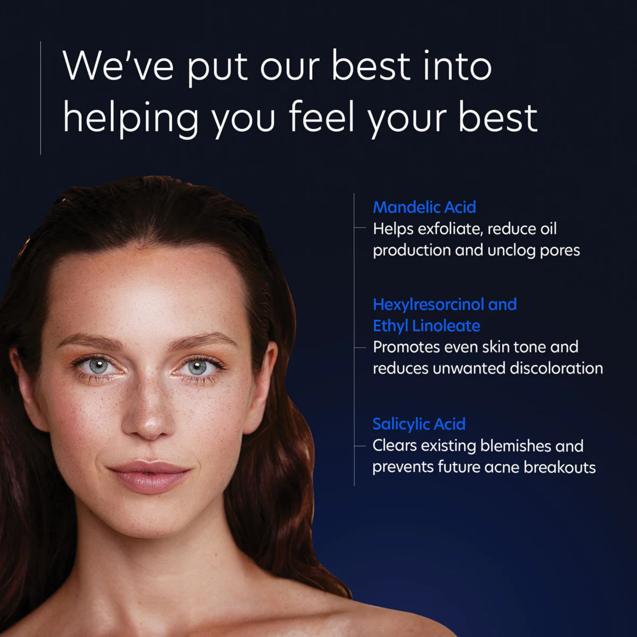 Acne Gel with Omnisome®